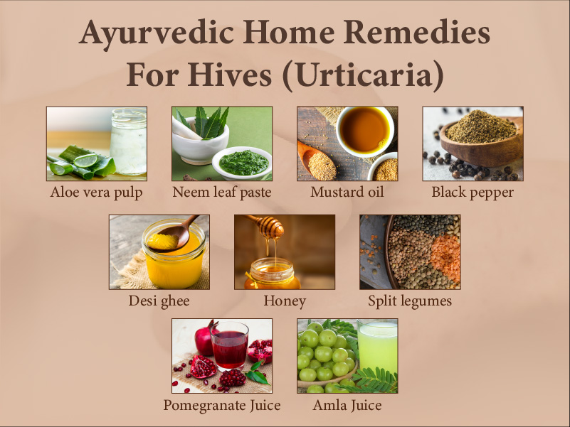 Urticaria - Ayurvedic Home Remedies