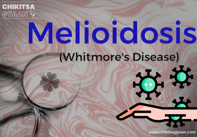 What is Melioidosis?