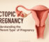 Ectopic Pregnancy – Understanding the “Different Type” of Pregnancy
