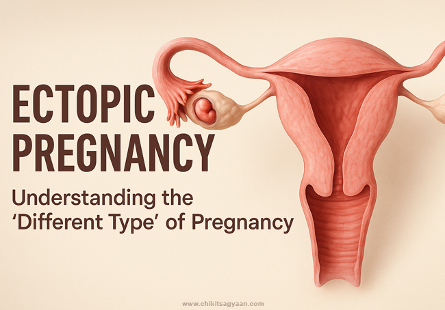 Ectopic Pregnancy – Understanding the “Different Type” of Pregnancy