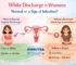 White Discharge in Women: Normal or a Sign of Infection?